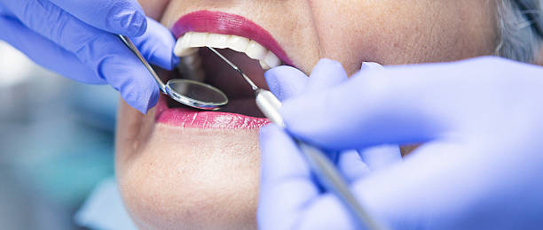 Best Dentist for Tooth Abscess  in Philippi, WV